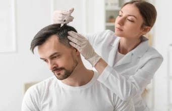 How to Plan an Alopecia Consultation in Mississauga or Toronto