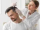 How to Plan an Alopecia Consultation in Mississauga or Toronto