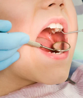 Why Dental Implant Prices Vary Between Patients