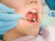 Why Dental Implant Prices Vary Between Patients