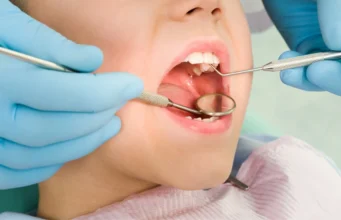 Why Dental Implant Prices Vary Between Patients